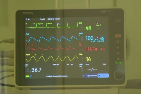 Leállt a lélegeztetőgép, kézzel kellett lélegeztetni egy koronavírusost Pécsen