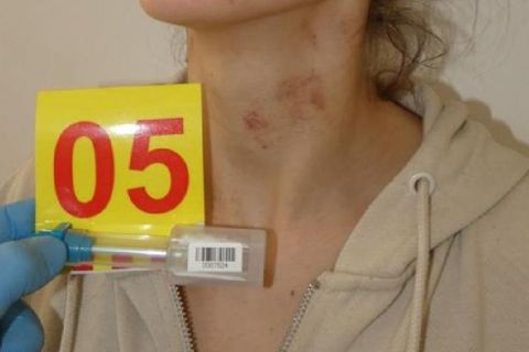 megkotozott-no-tolna