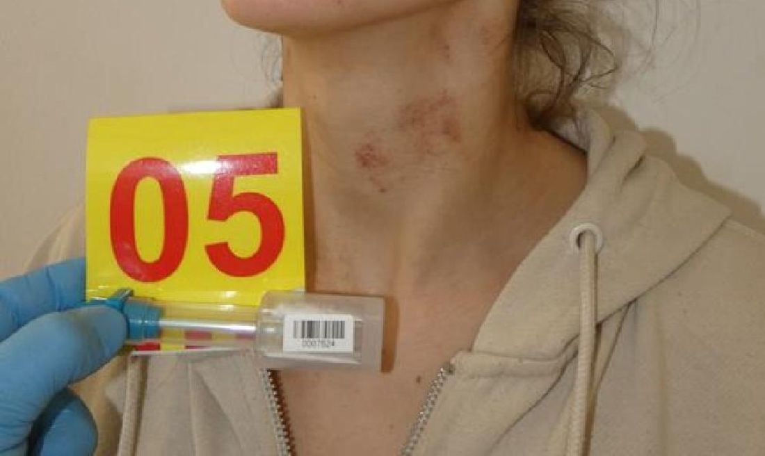 megkotozott-no-tolna